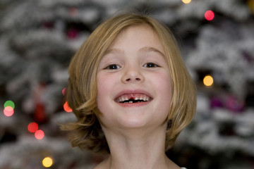 child missing teeth