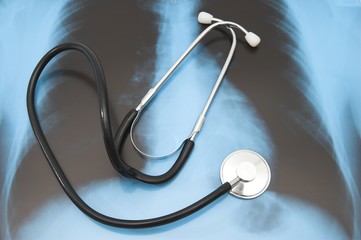 Stethoscope on xray photo of human chest
