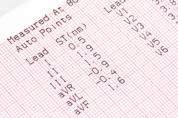 cardiographical test results, 