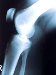 X-ray photography