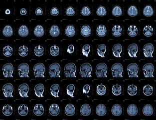 Obraz premium Brain and head MRI or CT images