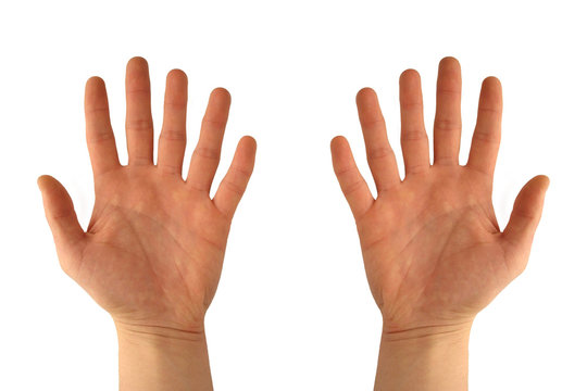 Hands with six fingers