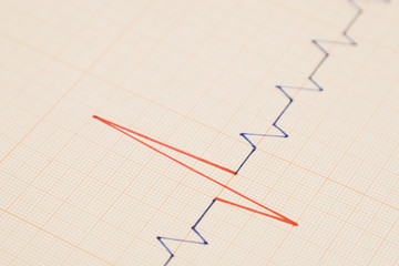 Cardio Graph. Hand made. Medicine series.
