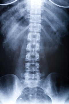  body x-ray photo for background