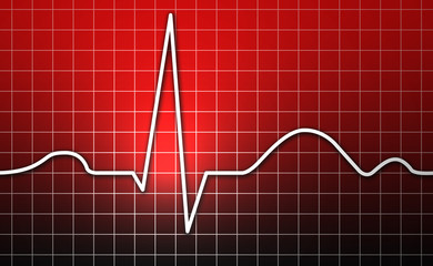 EKG, Herz, Kardiogramm
