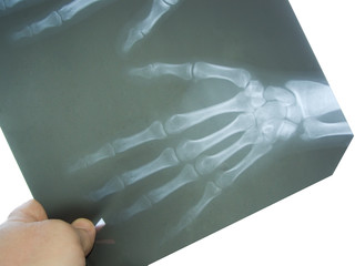 Doctor with x-ray of hand.