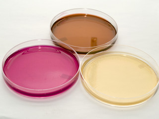  Bacterial petri dishes