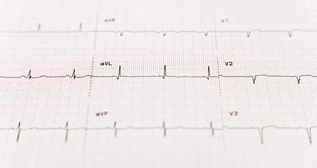 A 12 lead EKG or electrocardiogram with selective focus.