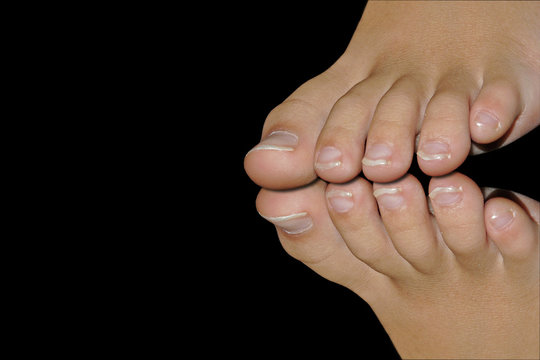 kinderf&uuml;&szlig;e