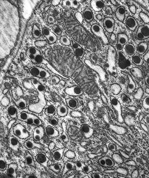 Human cell - electronic microscopy - biology