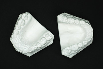 Gypsum model plaster of tooth - Upper View © Sunlove