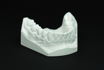 Gypsum model plaster of tooth - Lower