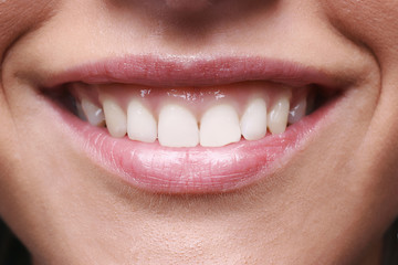 smile of young woman with white teeth