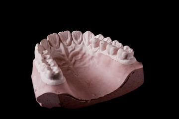gypsum model of a human teeth on black background