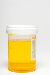 Urine Sample