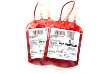 Two Neonatal Splits