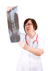 doctor looking at x-ray of backbone, spine