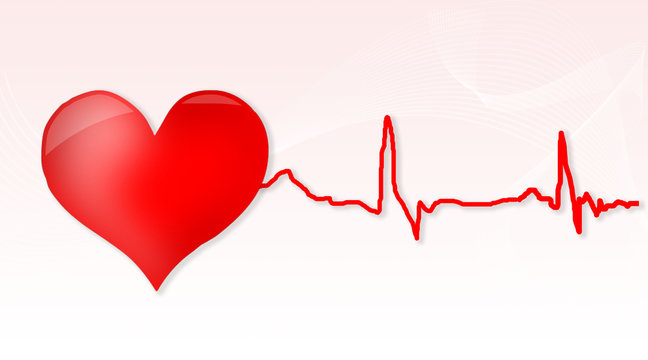 Cardiogramme