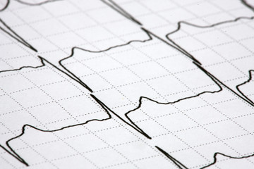 ekg