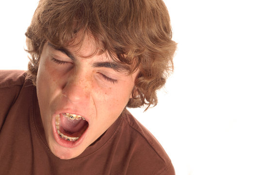 teenage boy having great big yawn with braces on his teeth