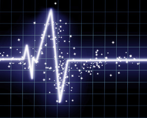 Heart beat on clinic monitor