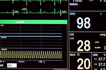 ecg