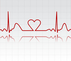 Illustration of electrical activity of the human heart