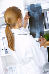 Doctor examining x-ray picture in her surgery