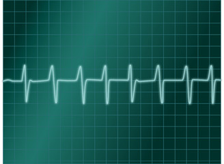 electro cardiogramme