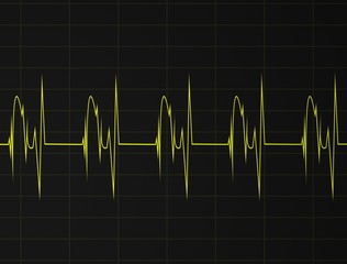 &eacute;tat critique