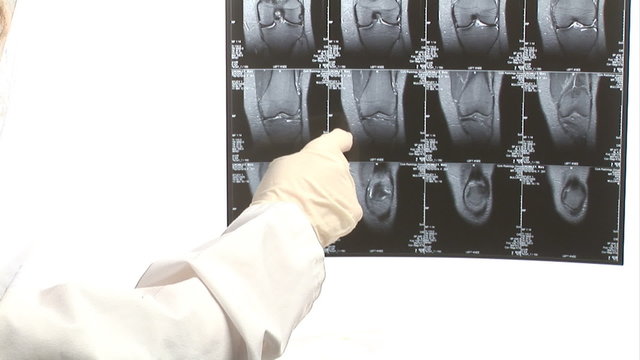 Doctor finger pointing to an X-ray