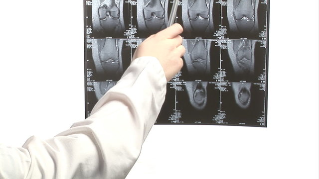 Stock Footage of Nurse with Xray Scan