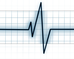 Heart beat on monitor