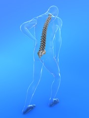 rückenschmerz darstellung