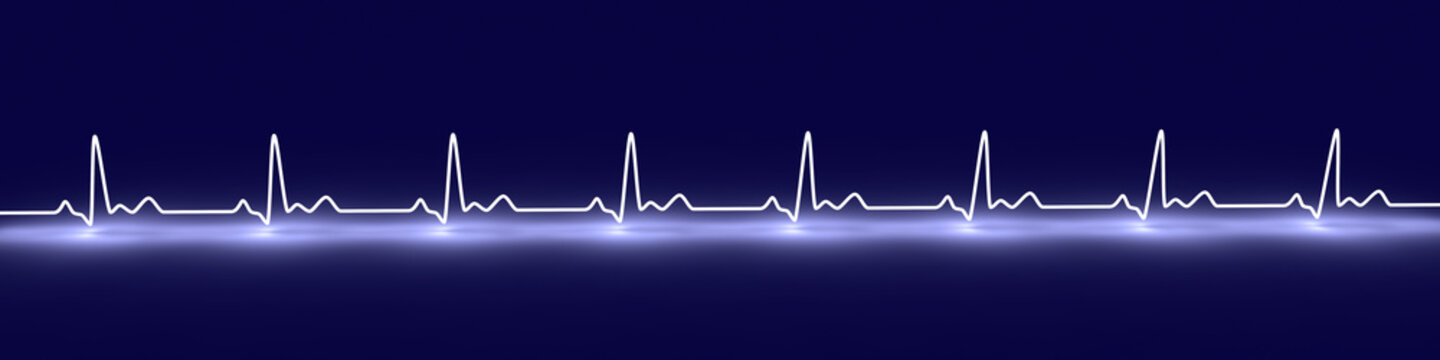 EKG Puls