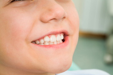 Fototapeta premium Smile of boy