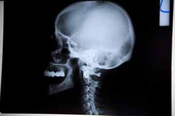 X-ray photo