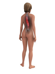 Fototapeta premium rückenschmerz illustration