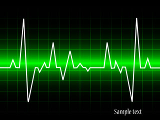 electrocardiogram- vector illustration