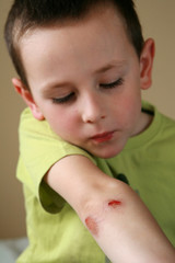 bleeding injured boy