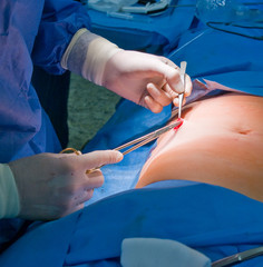 Operation