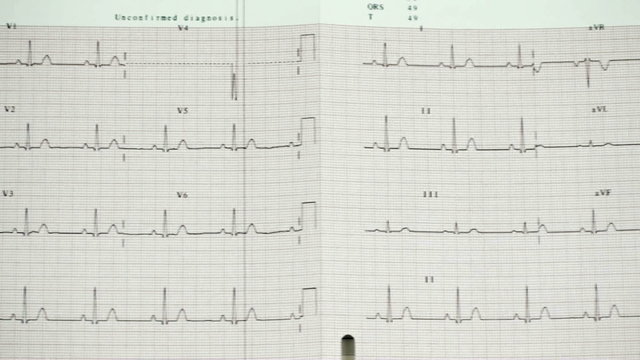 1080 Full-page ECG Recording