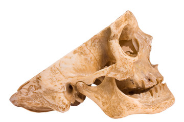 Bone-head