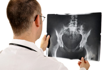 Arzt mit Röntgenaufnahme