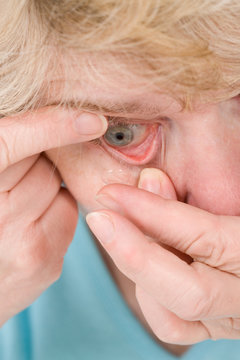 Lentilles de contact