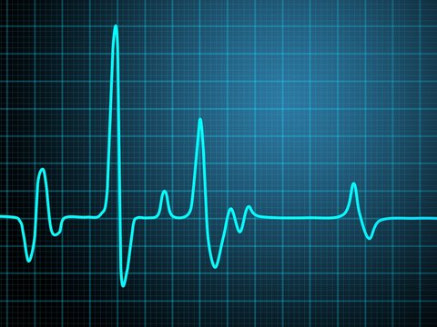 cardiogramme