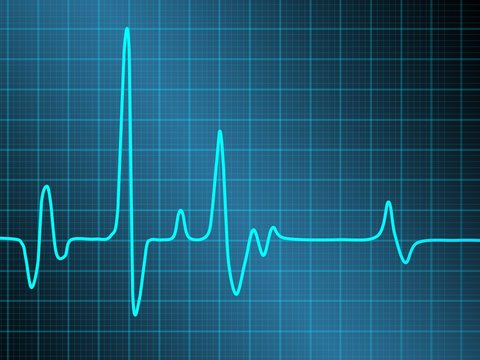 cardiogramme