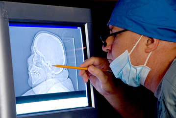 Brain Scan