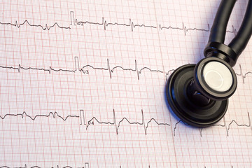 EKG