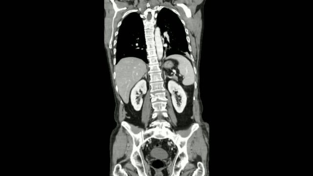 Radiology - abdominal and thoracic ct scan
